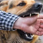 Dog Bite Injury laws