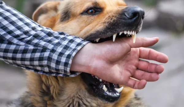 Dog Bite Injury laws